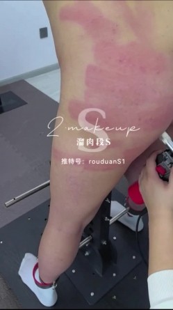 字母圈大神「熘肉段S」全量推特资源 大量M女奴来受虐，炮击、捆缚、虐阴、鞭打 截图14