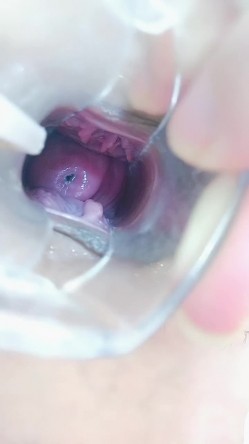 双插母狗风骚少妇，道具玩弄逼逼和菊花，特写展示扩阴器看子宫G点，淫声荡语不断，逼逼塞鸡蛋自己吐出来 截图4