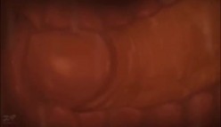 300米自购小狐狸主播 ️-性学课堂-珂珂- ️土豆群真人裸体教学视频 10V，知识大讲堂，开眼界了！ 截图16