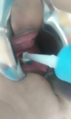 《稀缺资源 震撼狠货》推特字母圈网红SM界天花板重度性虐大师【I_m_ur】各种极限调教私拍~扩张 异物 虐阴虐尿道花样繁多 截图4
