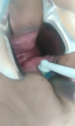 《稀缺资源 震撼狠货》推特字母圈网红SM界天花板重度性虐大师【I_m_ur】各种极限调教私拍~扩张 异物 虐阴虐尿道花样繁多 截图11