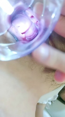 母鸡下蛋，极品小少妇玩的很花啊，给逼逼里塞鸡蛋和甜枣，从逼里吐出来给狼友吃，扩阴器看子宫看尿道尿尿 截图2