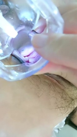 母鸡下蛋，极品小少妇玩的很花啊，给逼逼里塞鸡蛋和甜枣，从逼里吐出来给狼友吃，扩阴器看子宫看尿道尿尿 截图4