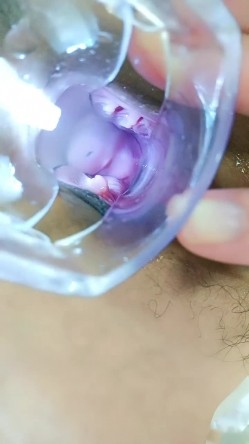 母鸡下蛋，极品小少妇玩的很花啊，给逼逼里塞鸡蛋和甜枣，从逼里吐出来给狼友吃，扩阴器看子宫看尿道尿尿 截图8