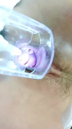 母鸡下蛋，极品小少妇玩的很花啊，给逼逼里塞鸡蛋和甜枣，从逼里吐出来给狼友吃，扩阴器看子宫看尿道尿尿 截图13