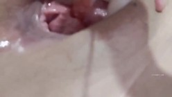 《稀缺资源 震撼狠货》推特字母圈网红SM界天花板重度性虐大师【I_m_ur】各种极限调教私拍~扩张 异物 虐阴虐尿道花样繁多 截图5