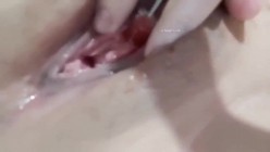 《稀缺资源 震撼狠货》推特字母圈网红SM界天花板重度性虐大师【I_m_ur】各种极限调教私拍~扩张 异物 虐阴虐尿道花样繁多 截图9